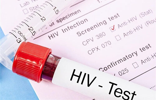 ۲۳ هزار بیمار مبتلا به ایدز در کشور شناسایی شد